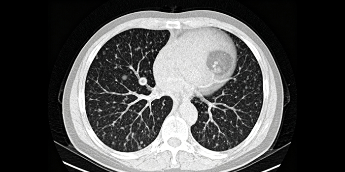 Medical Testing: How Sony ILX-LR1 Becomes a High-Precision 